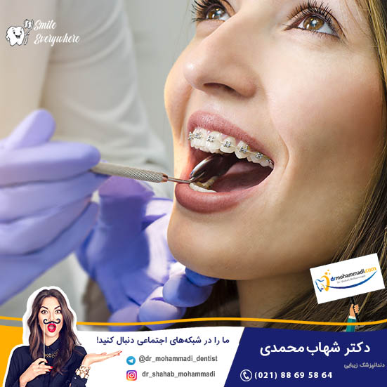 بهترین متخصص ارتودنسی در تهران را چطور بشناسیم؟ - کلینیک دندانپزشکی دکتر شهاب محمدی